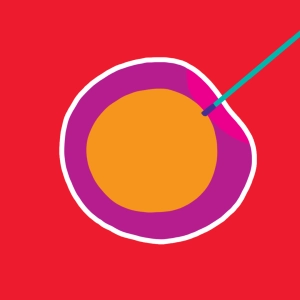 Fertilización in vitro (FIV)